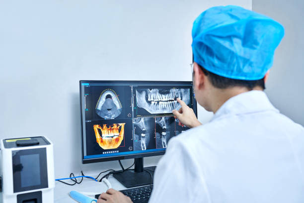 Best Knocked-Out Tooth (Avulsed Tooth) Treatment in Red Wing, MN